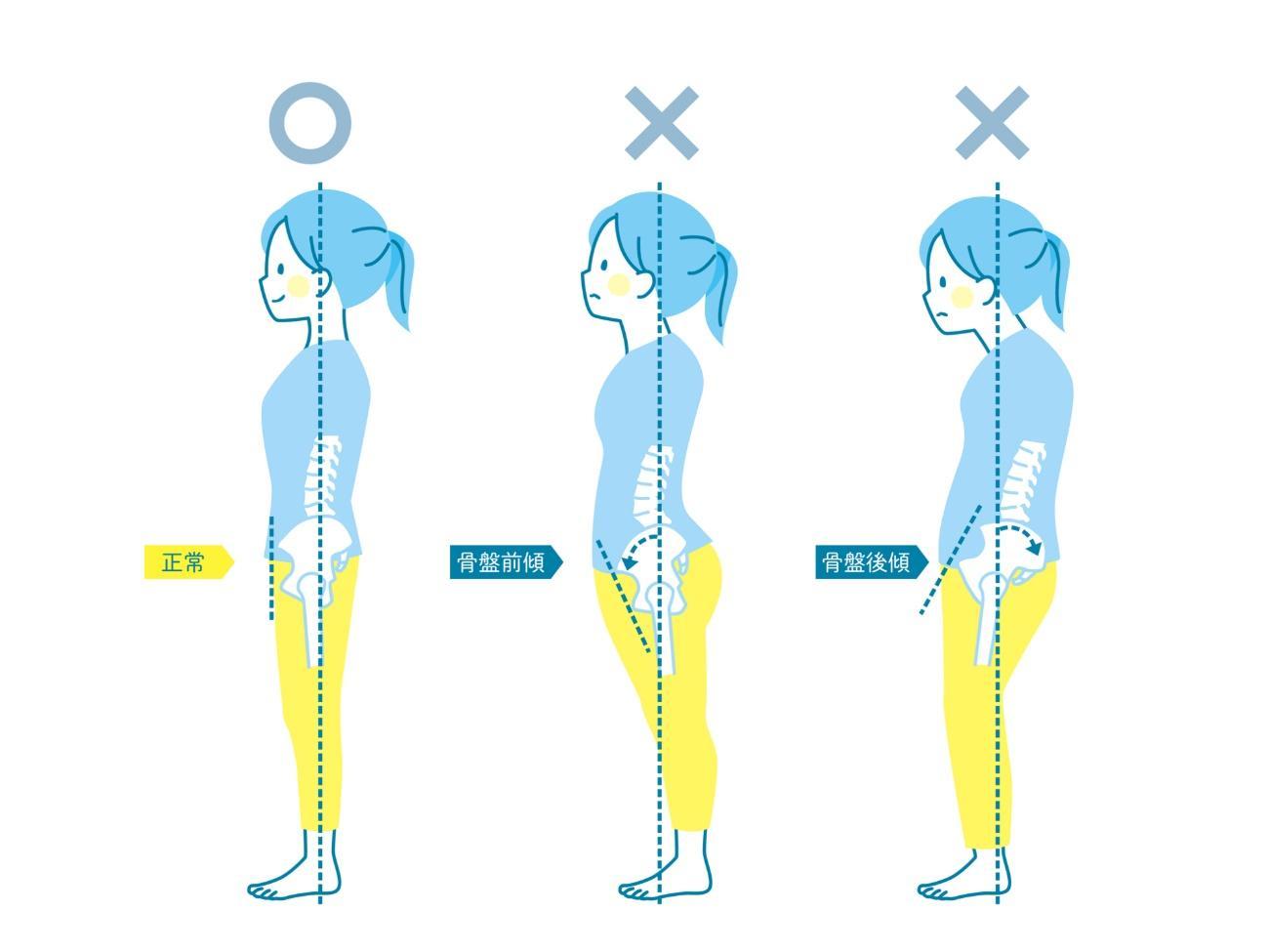 姿勢や骨盤のゆがみを整えるストレッチ3選