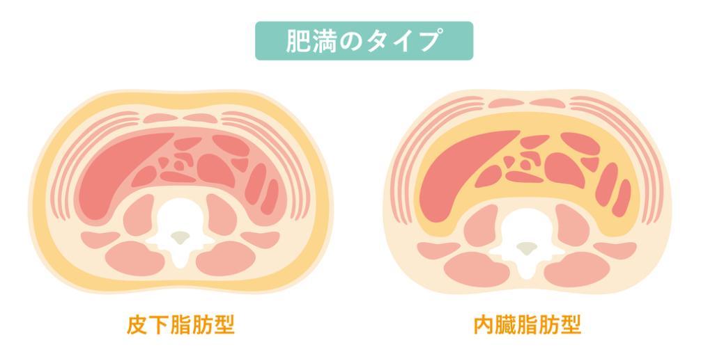 お腹周りの浮き輪肉の正体とは？